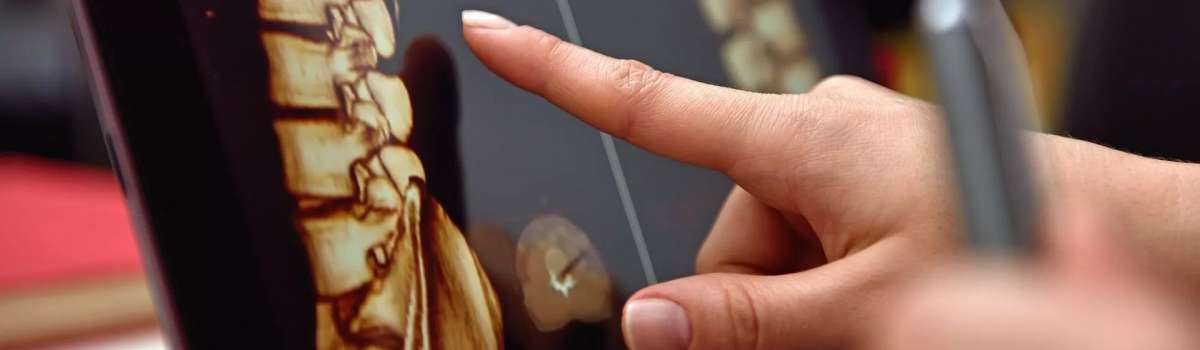 Ανάλυση Στάσης Σώματος Ανάλυση Στάσης Σώματος